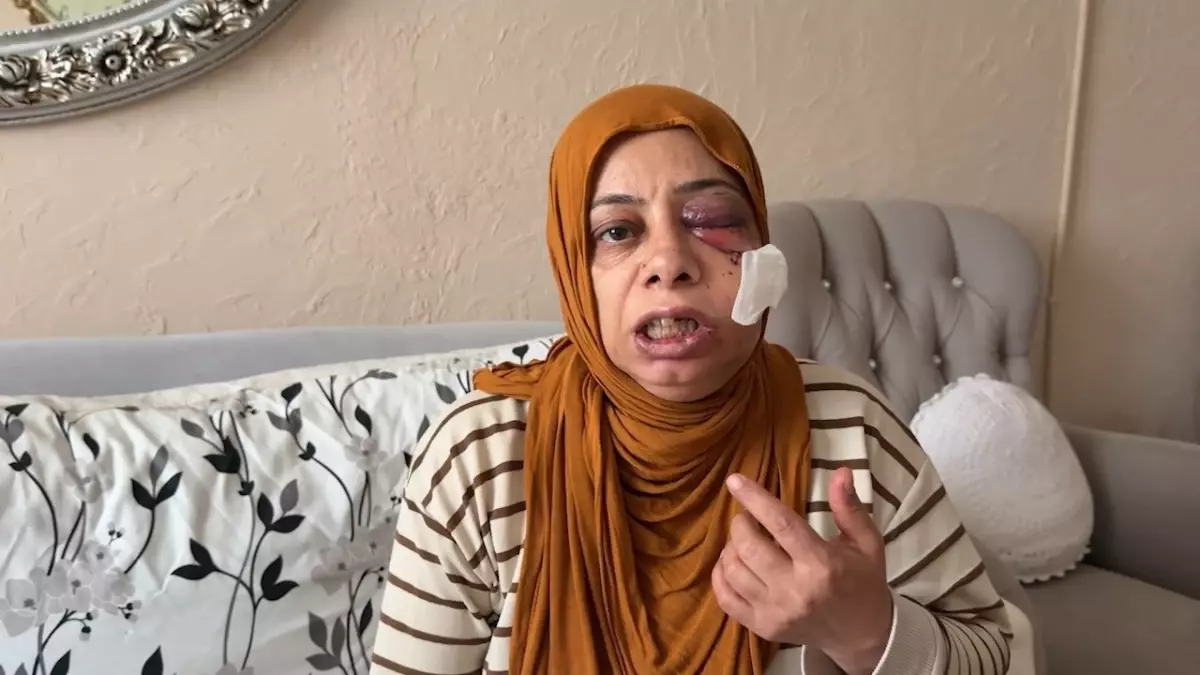 Akraba ziyaretine giderken bu hale geldi